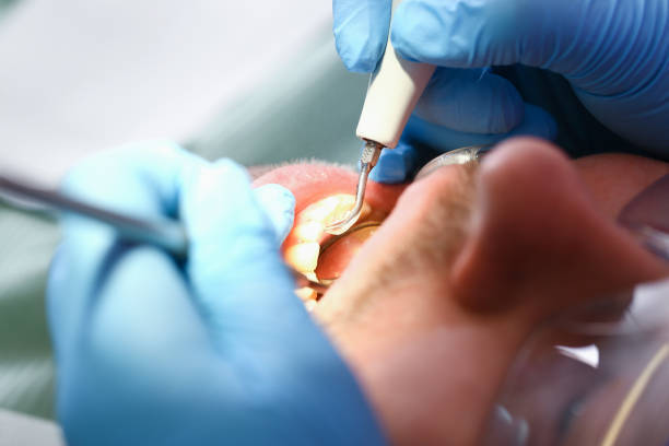 Best Emergency Root Canal Therapy in Gholson, TX